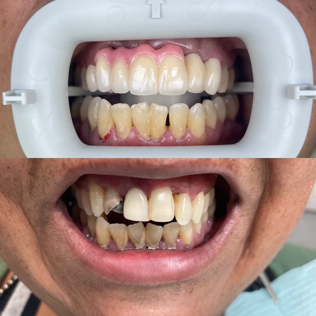 Chairside before and after