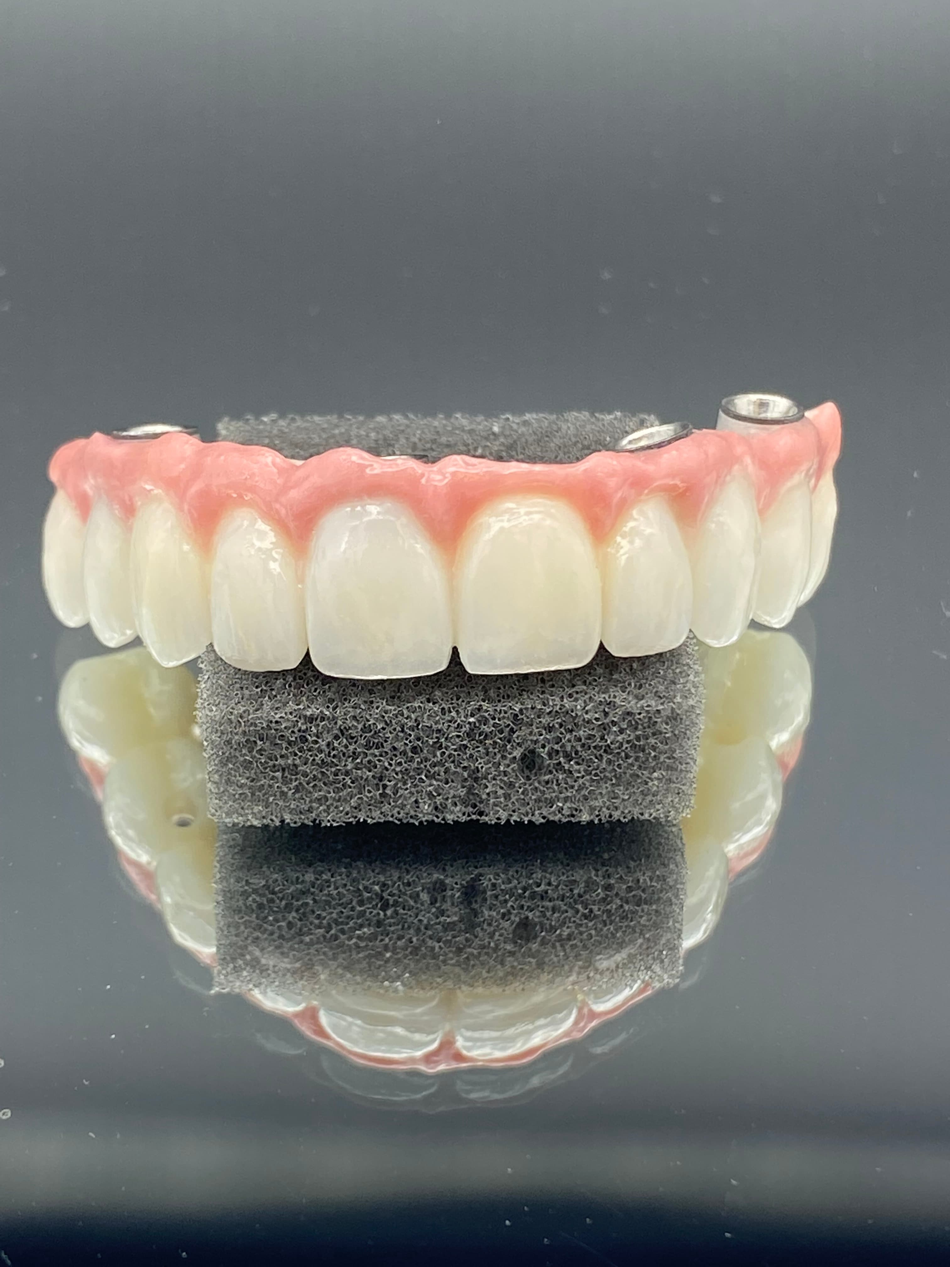 Implant-supported denture detail