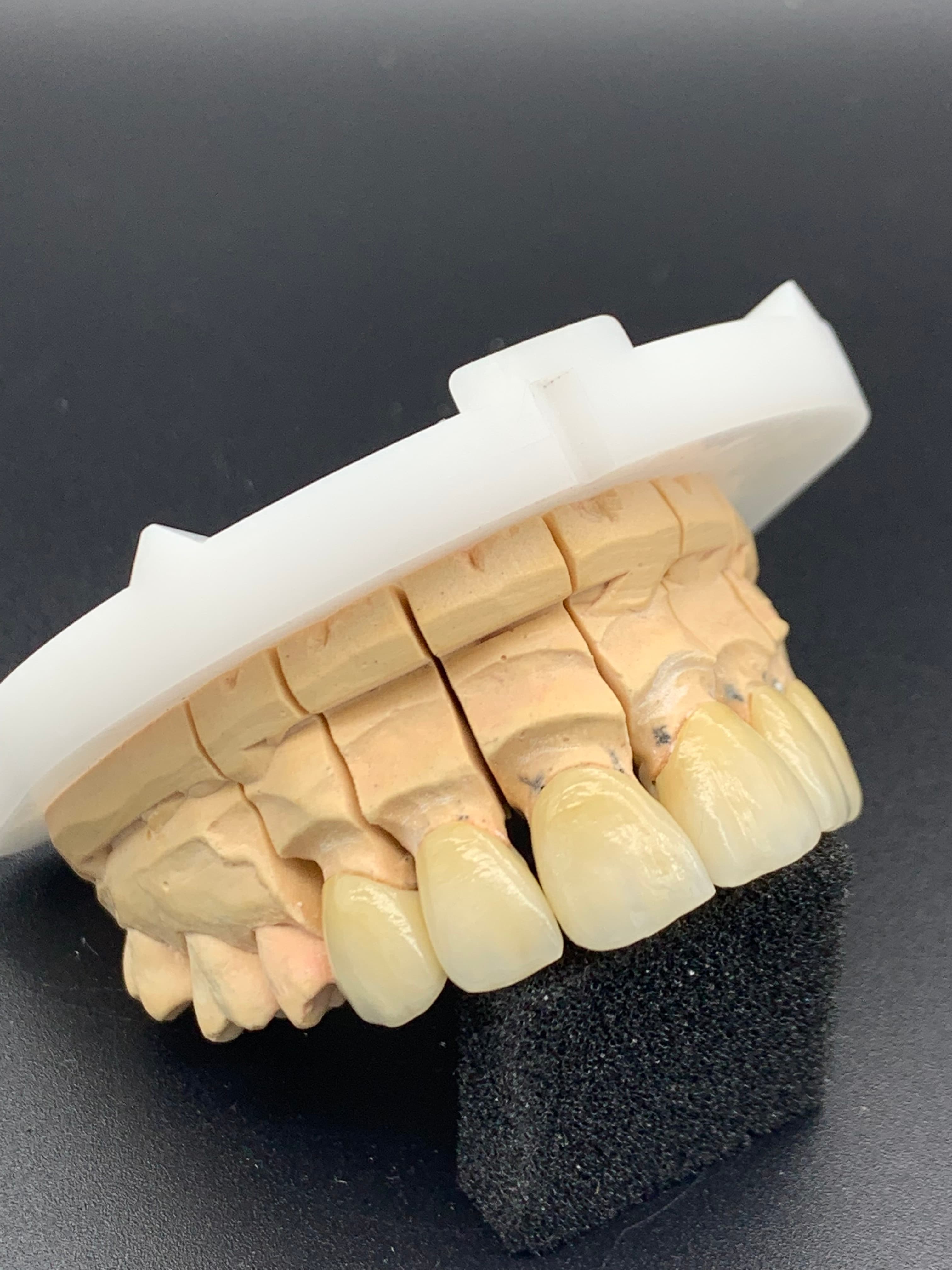 Restoration angle and contour