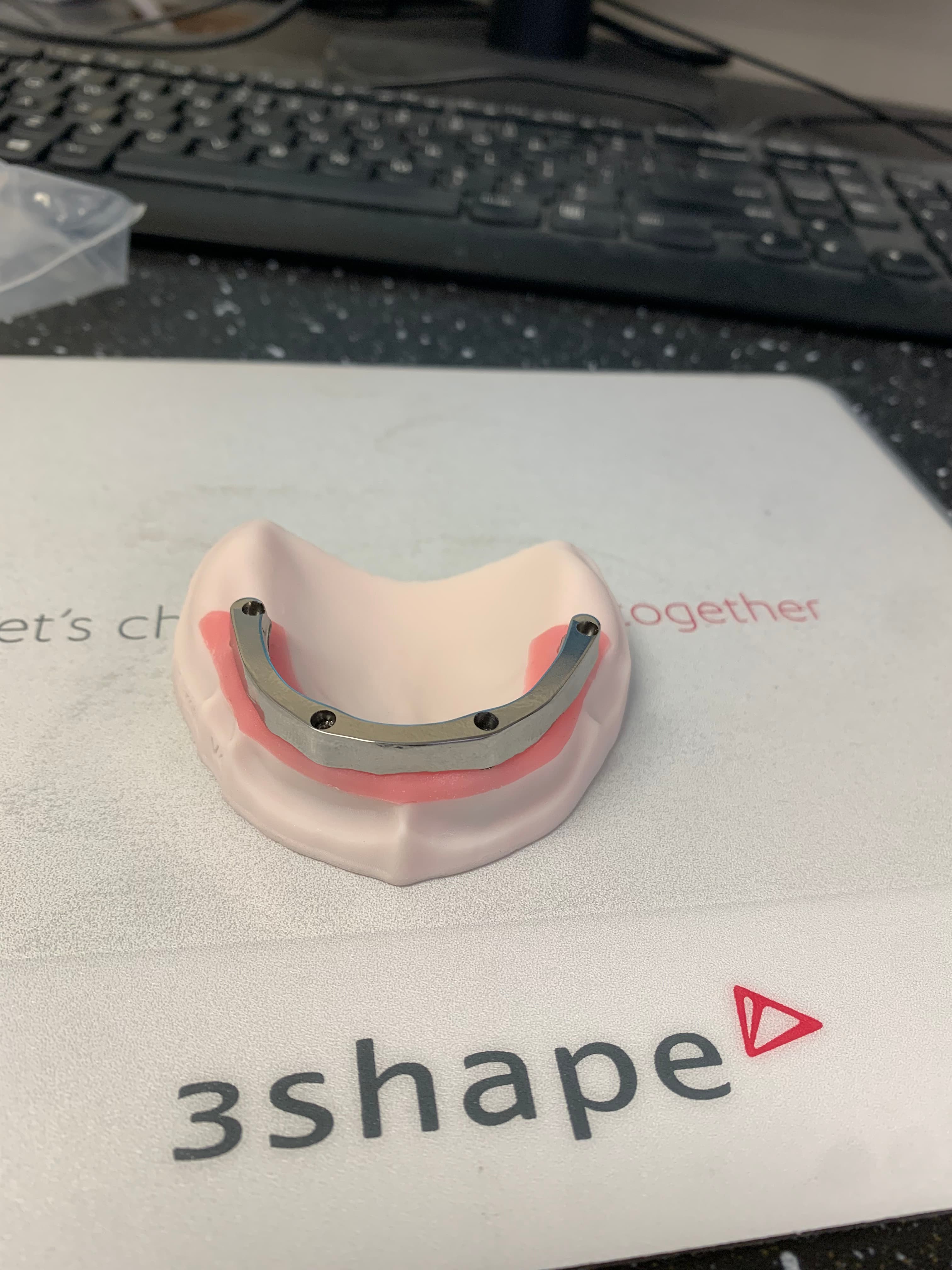 Implant bar setup