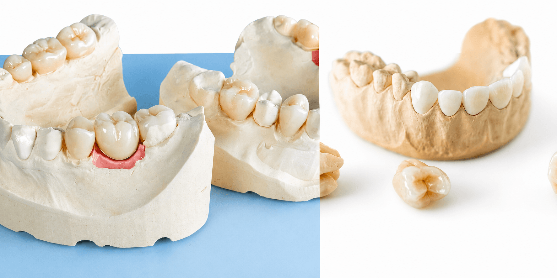 Fixed prosthetics crown work